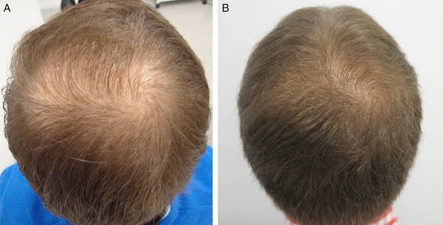 RoseMary Hair Growth Oil